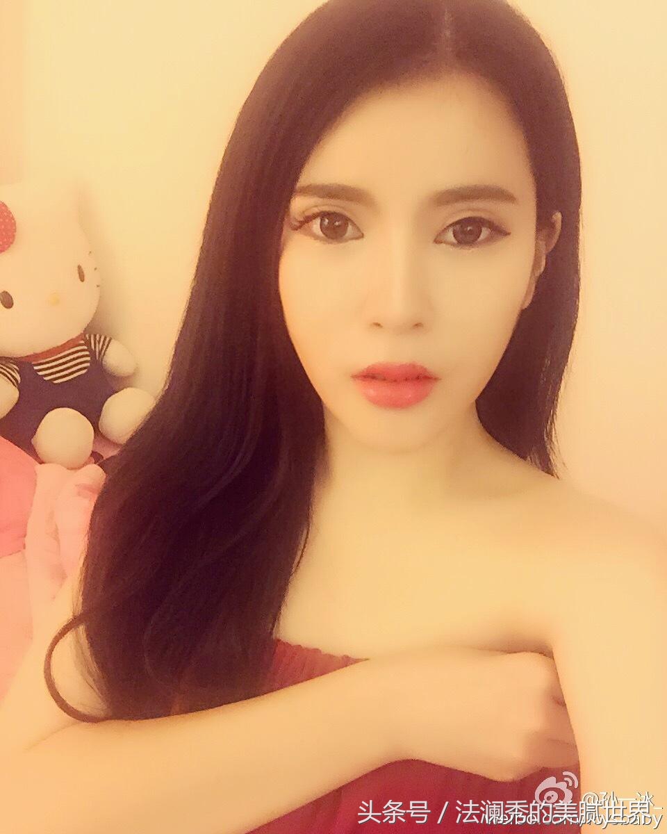 祛斑成功堪比整容,激光祛斑显老