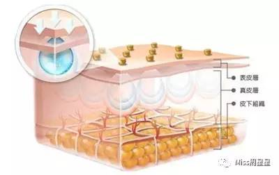 嫩肤提拉控油美容仪,淡斑嫩肤提拉美容仪
