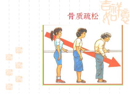 更年期健康讲座,健康科普绝经早了怎么办