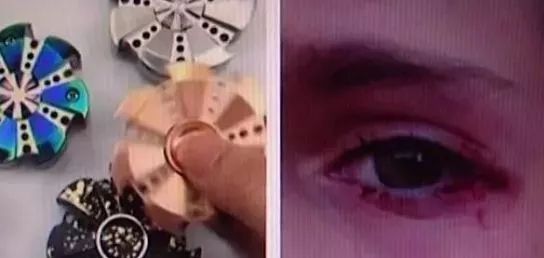 小孩玩激光笔照瞎了,男童玩激光笔已经眼睛受伤视频