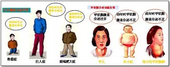 桥本氏甲状腺炎如何保养,按摩什么穴位可以保养甲状腺