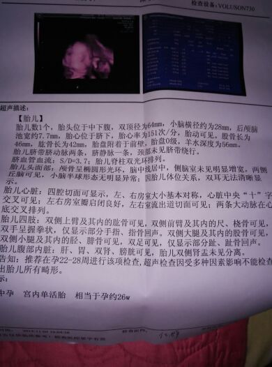 宝妈分享怀宝宝的症状,怀了女宝初期感受