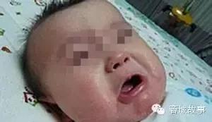 湿疹痒痒如何缓解,湿疹痒痒处能拍打么