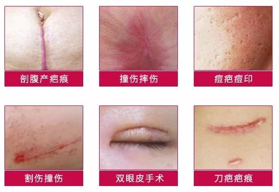 药妆效果比普通差吗,理肤泉与雅漾哪个好