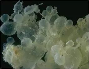 医生说我怀孕了是宫外孕,医生说我怀了多胞胎