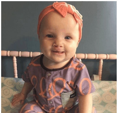 怀孕5个月了查出宝宝兔唇,孕妈没有按时产检娃有兔唇