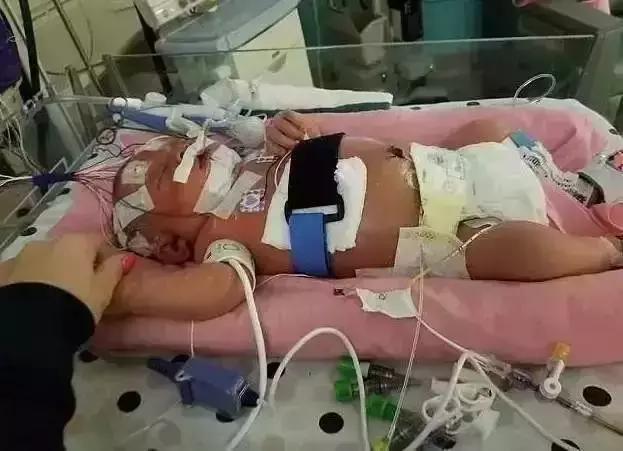 亲吻宝宝对宝宝有好处吗,大人亲吻宝宝会让宝宝得什么病