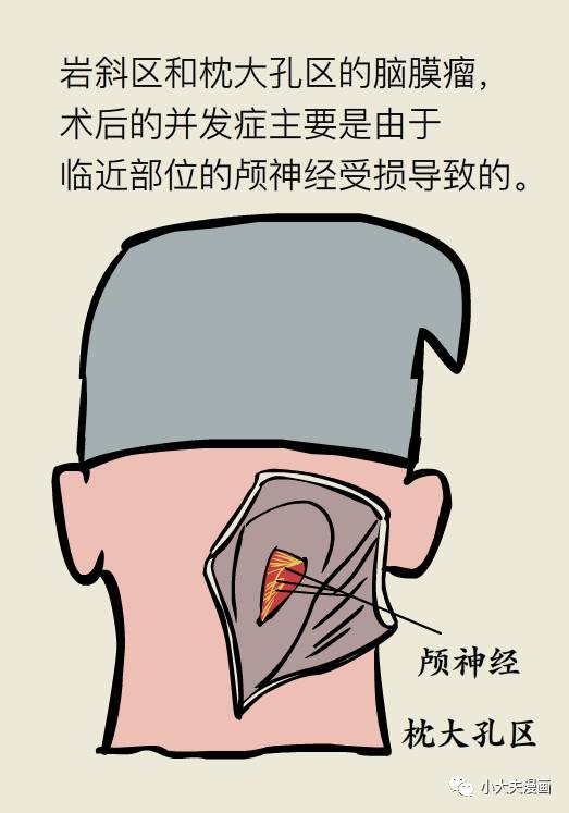 脑袋长瘤吃什么食物好,脑袋里长瘤子会死吗