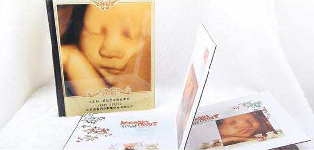 怀孕做B超，这些是医生不会对你说的秘密