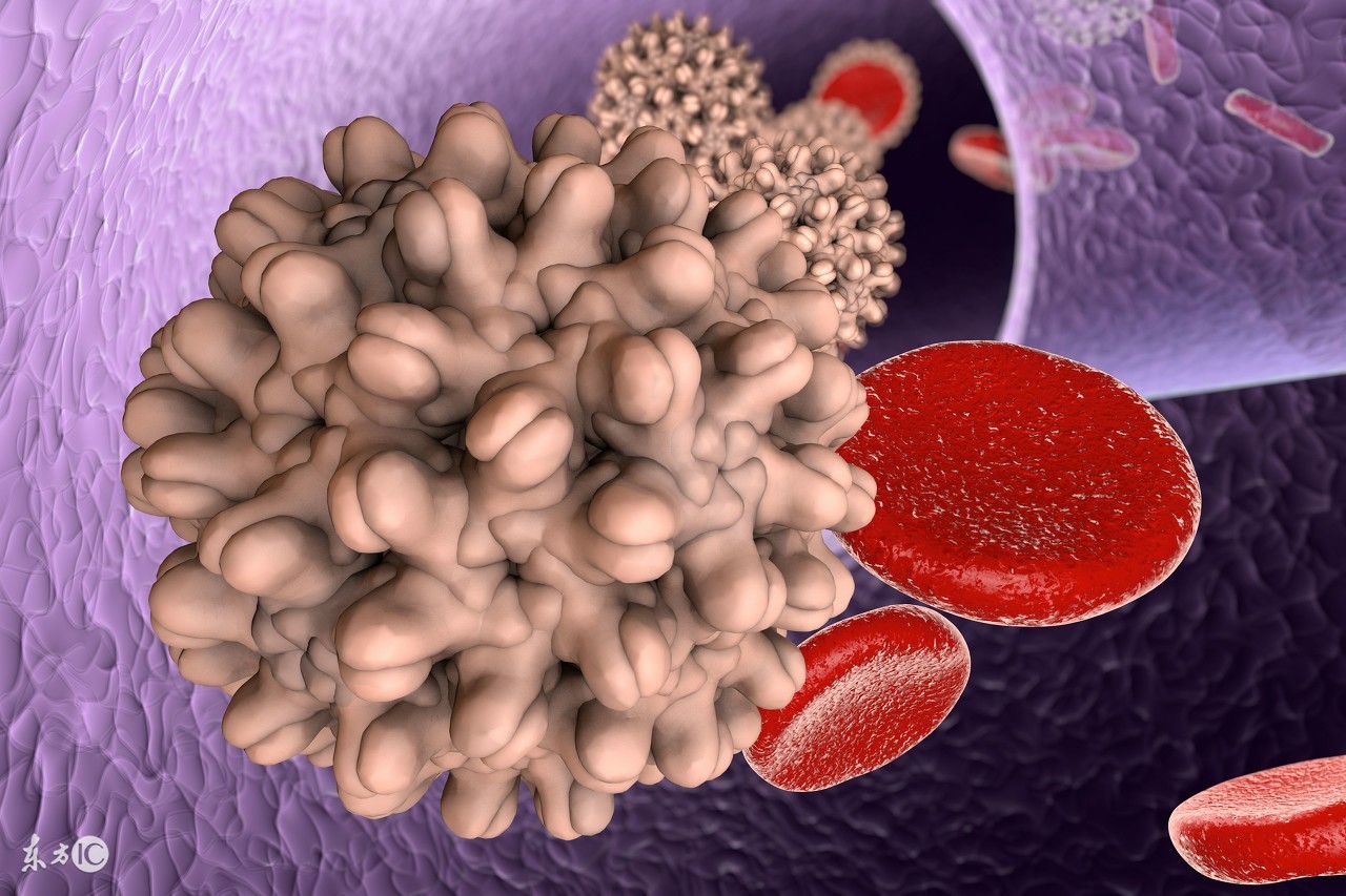 乙肝患者发生肝硬化，不要害怕，关键是要做到以下一点