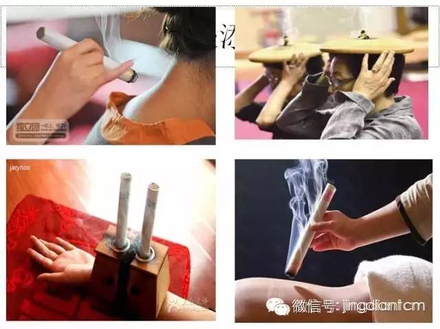 中医名家艾灸视频全集,中医艾灸知识100例
