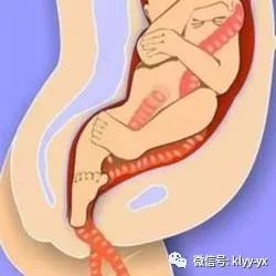 生宝宝出现意外,生宝宝会遇到的情况