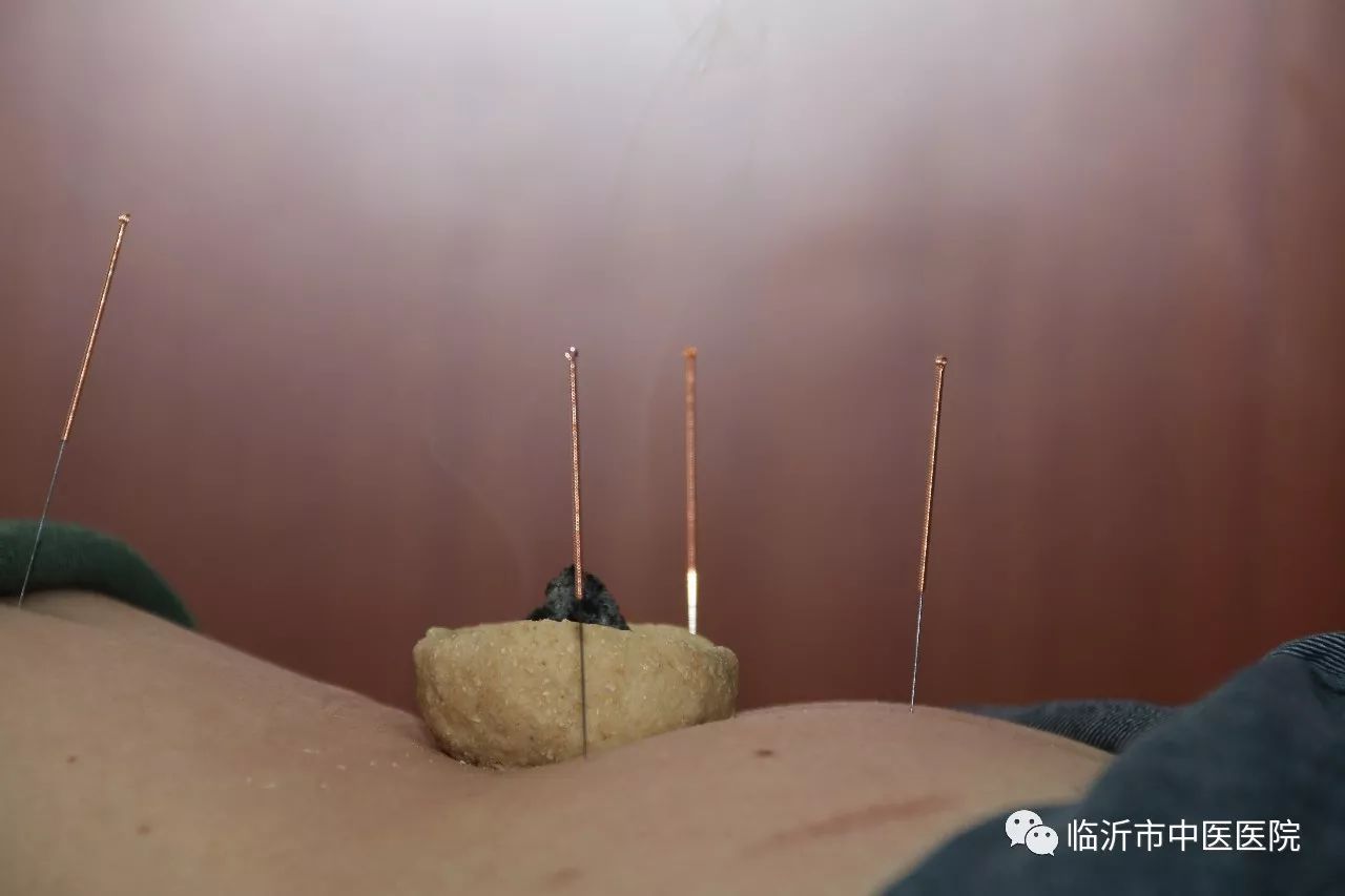 掌握经典的艾灸方法,最好的中医艾灸