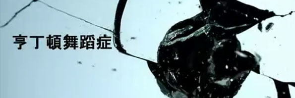 英科学家阻断mRNA信号，首次用药物实现了对“舞蹈症”的直接治疗