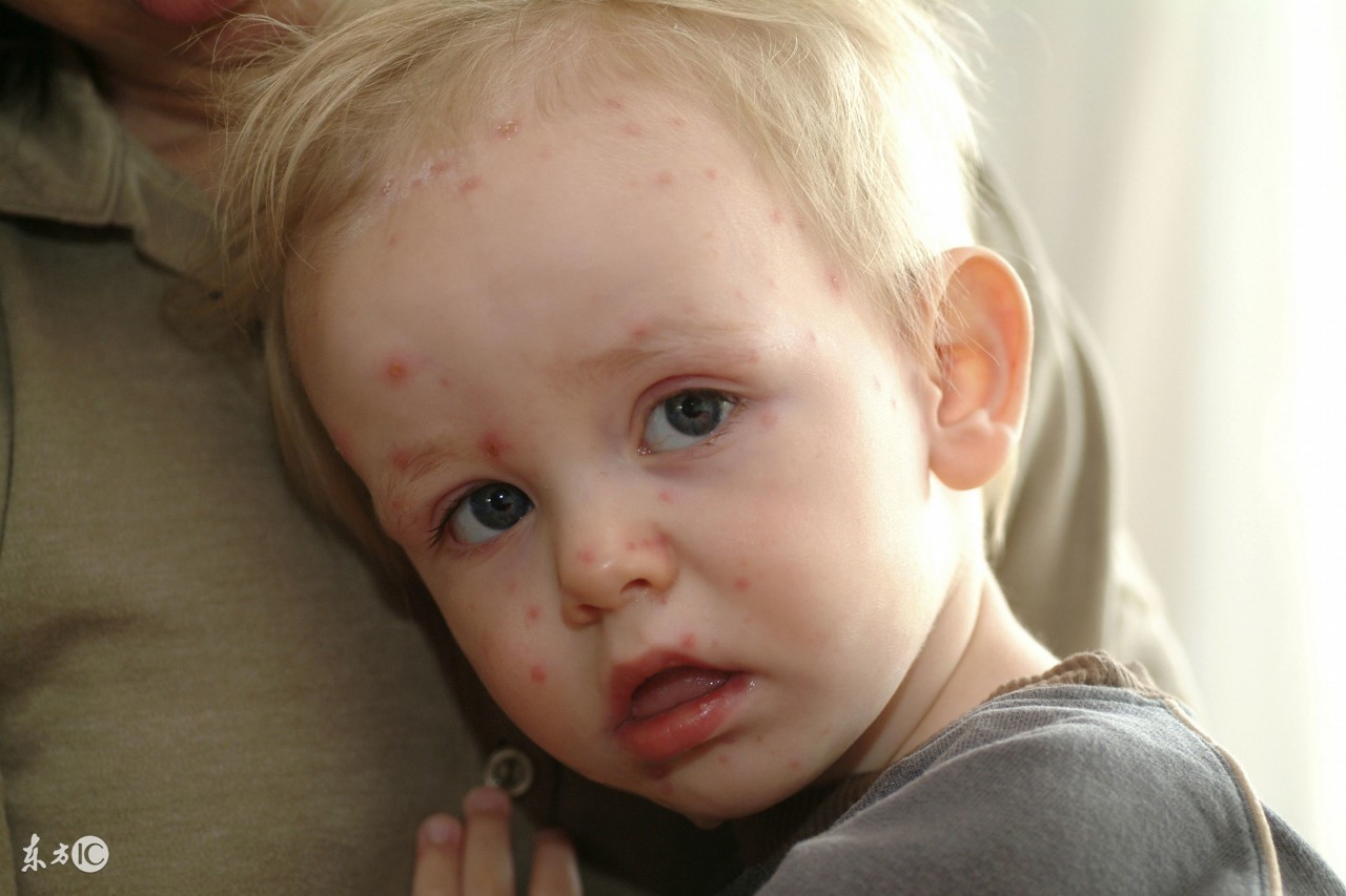 小儿易患各种传染病年龄,幼儿期易患的疾病