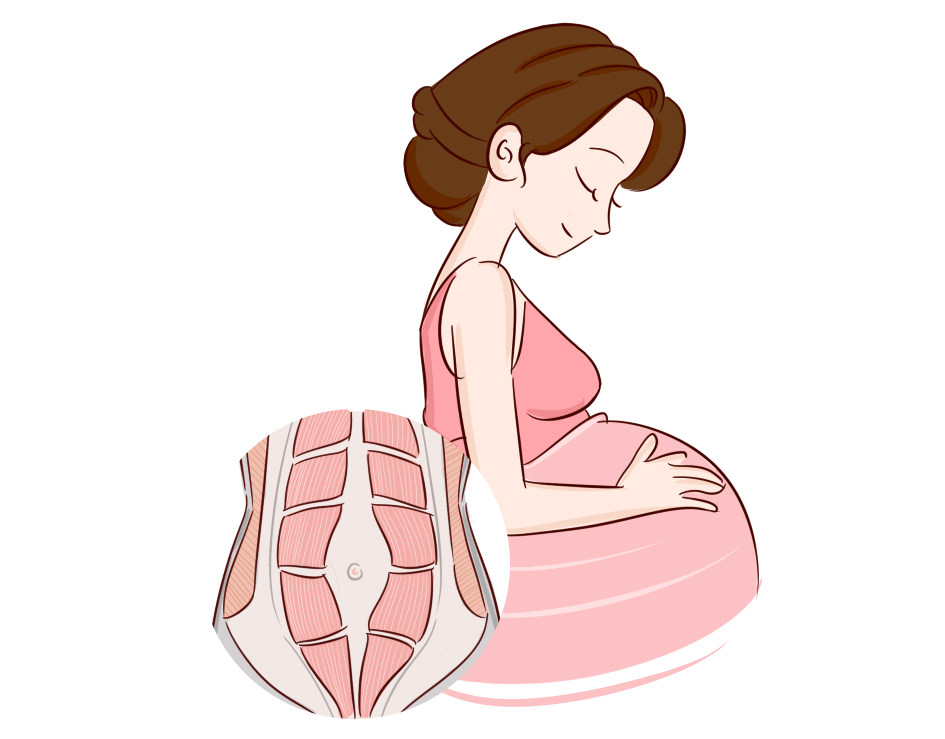 为什么很多人顺产侧切,是不是大部分孕妈顺产都会撕裂