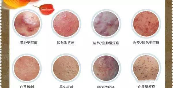 丽人妆容,丽人祛痘祛斑美白祛皱