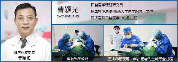 骨粉植牙失败,植牙失败后第二次种会成功吗