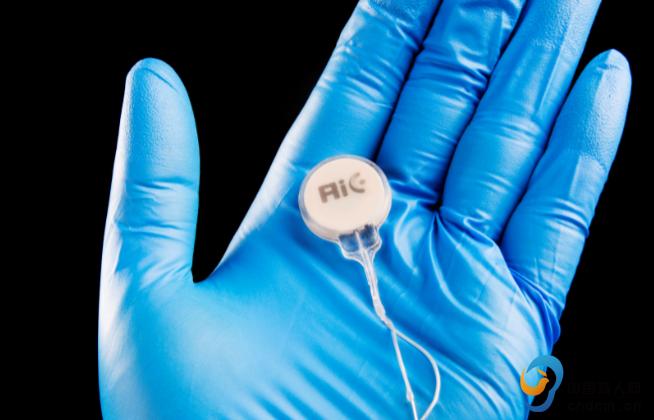 做人工耳蜗需要多少费用,一个人工耳蜗终身需要多少费用