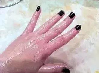 冬天手又红又紫怎么办,冬天手特别干燥怎么样可以保湿