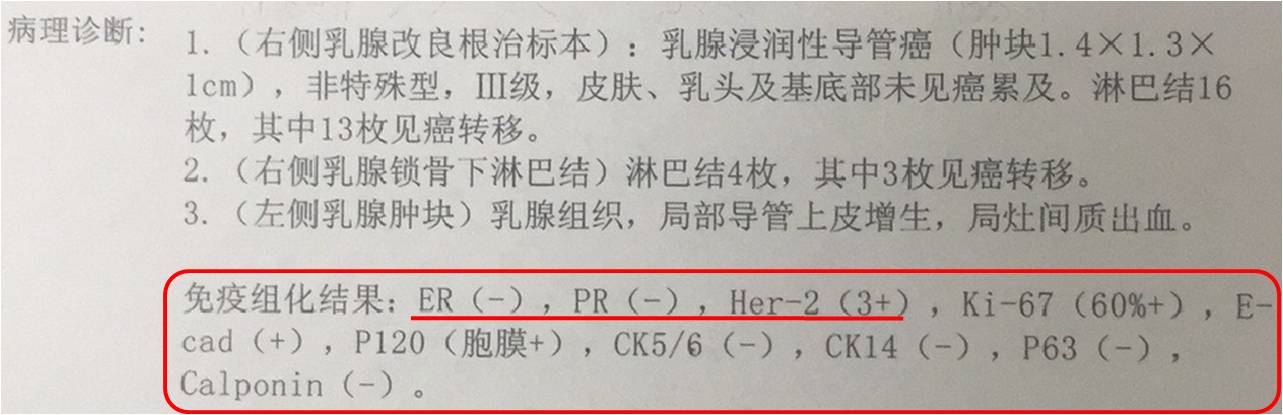 如何读懂乳腺癌病历单,怎么看懂乳腺癌的病理报告