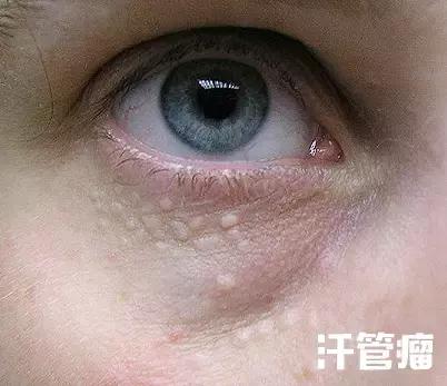 辟谣护肤界盛传的谣言,辟谣这9条护肤谣言真是害人不浅