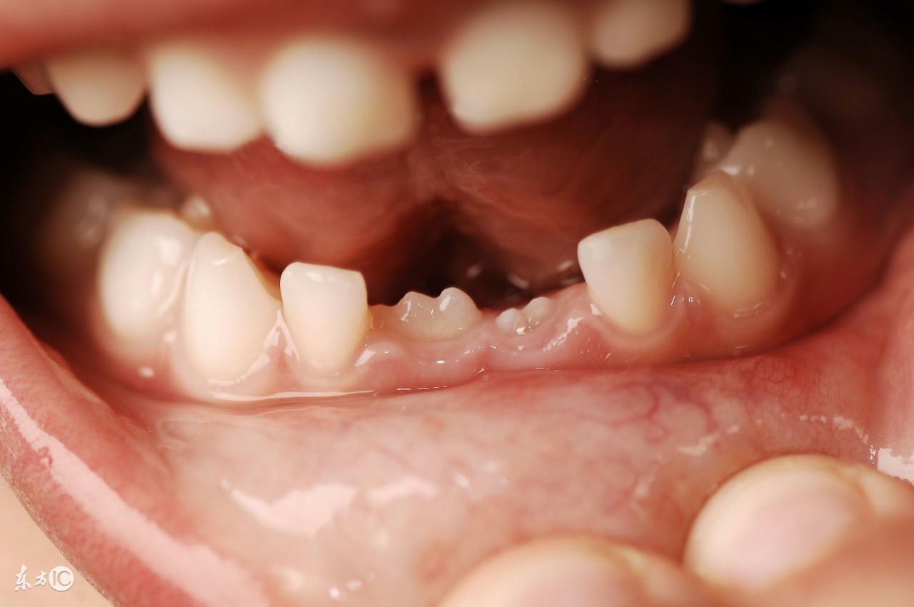 宝妈不要等孩子治疗牙齿时疼痛再陪着哭泣，认真护理乳牙才是根本