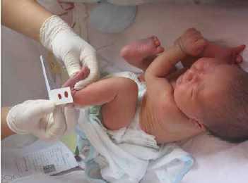 新生儿有没有必要做足跟血,新生儿的足跟血有必要查吗