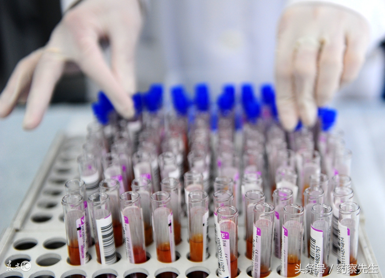 丙肝检测需要多长时间,丙肝检测最佳时间