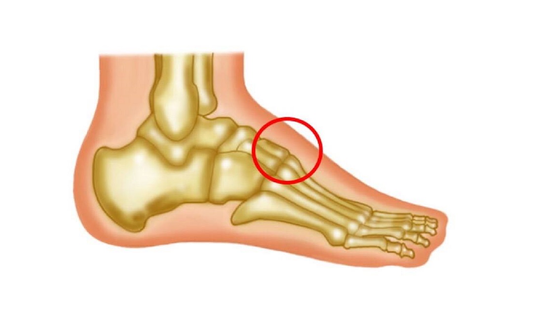 奥运会运动员扭伤用药,奥运会运动员康复训练