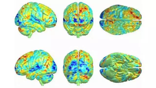 为什么一首歌听多了感觉很奇怪,为什么有些歌听几遍就腻