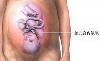 对于选择剖腹产的孕妈妈而言,到底剖腹产是怎样的?(图解)