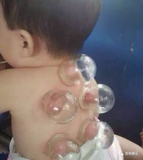 中医治疗儿童感冒经典处方,杏林中医治疗什么病最好