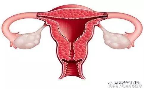 「助你好孕」子宫内膜薄？别怕，助你好孕为您支招！