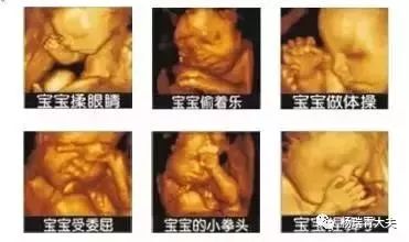 孕妇要做哪些检查项目表,孕妇要做哪些检查