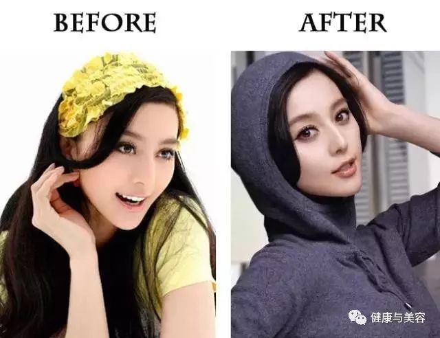 杨幂、唐嫣、神仙姐姐的鼻子原来是这样“整的”！