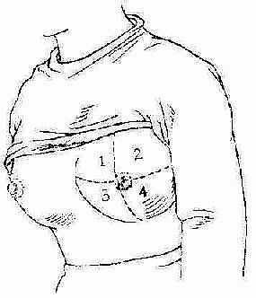 好险!谁说小乳房患癌易发现?这里有一个差点漏诊的病例