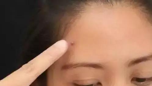 小黑瓶为什么是红色,小黑瓶是不是白里透红