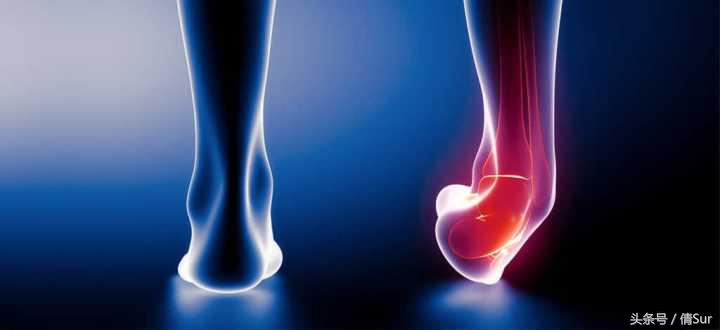 轻度脚踝扭伤几个疗程,脚踝反复扭伤的旧伤怎么治疗