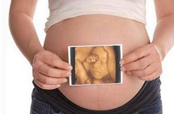 四维彩超预测宝宝长相项目,四维彩超可以看到小孩样子吗