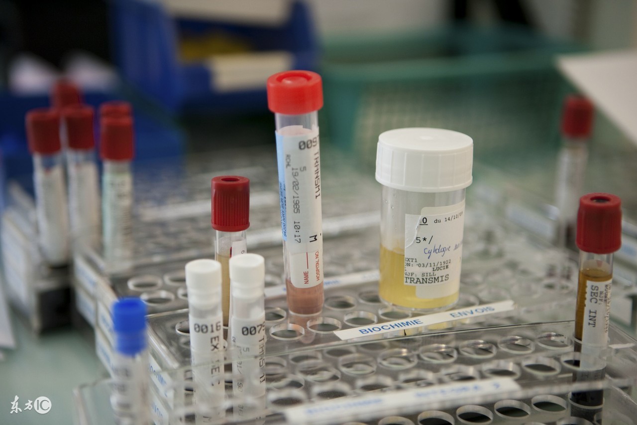 化验尿的全套项目有哪些,化验尿的正确方法视频