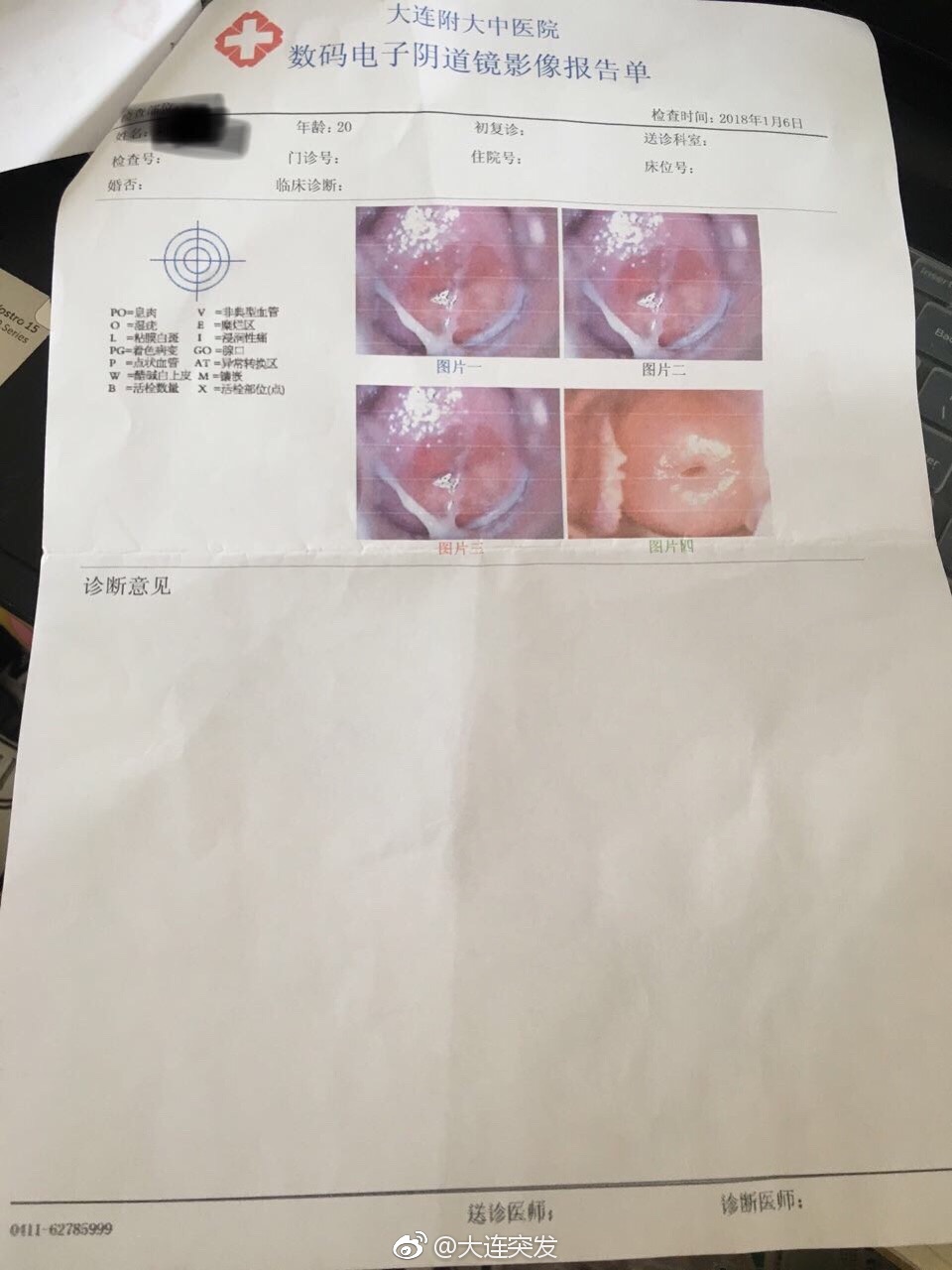 做个妇科活检多钱,做个妇检要多少钱