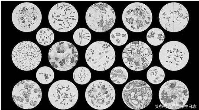 人人喜欢的钱币，其实是最脏的东西，快看看有多脏