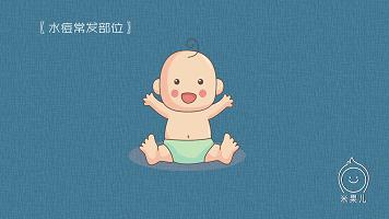 宝宝过敏怎么办新手爸妈秘籍,妈妈过敏体质宝宝怎么办