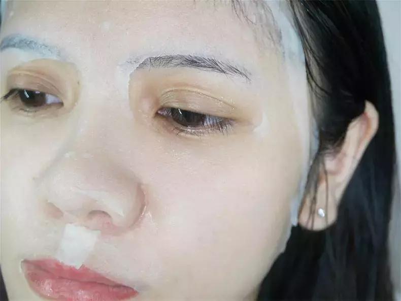 挤不干净的痘痘会长什么,挤不完的痘白色的