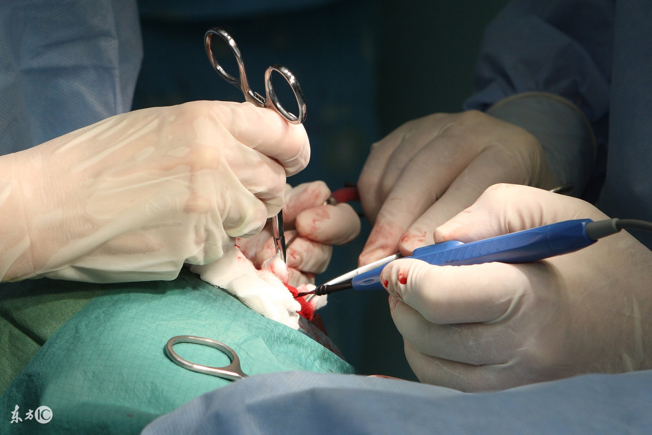 女子做妇科手术下单跑腿,女子被医生告知手术加价