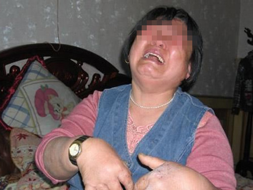 家长给女儿洗澡时发现腹部鼓起,父母给孩子洗澡发现肚子特别大