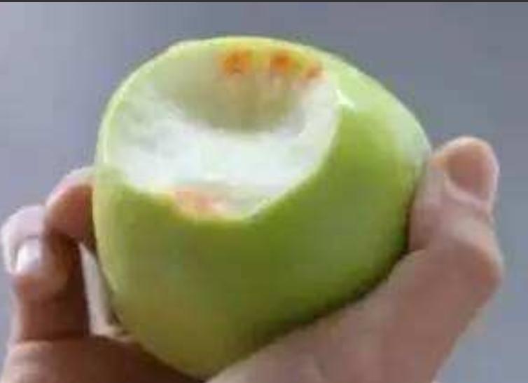 早期牙周病的症状,什么是牙周病及症状表现