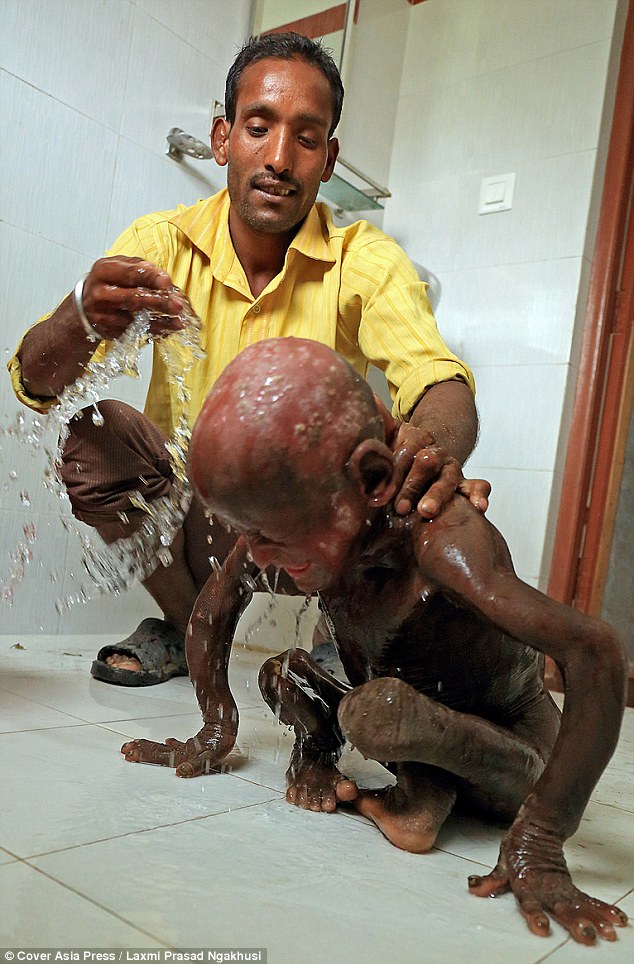 小男孩一出生就得到了一种怪病,男孩从小智力有残缺长大后被孤立