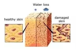真假黑头教你如何正确去黑头,如何辨别黑头以及正确使用产品